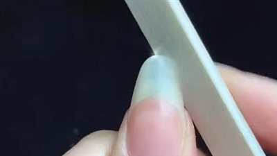 اصفرار الاضافر اسباب وحلول 