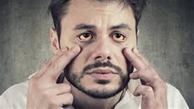 اعراض نقص النحاس