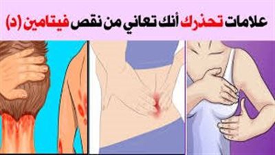 ماذا يسبب نقص فيتامين د