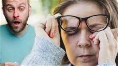نقص فيتامين د وأعراضه