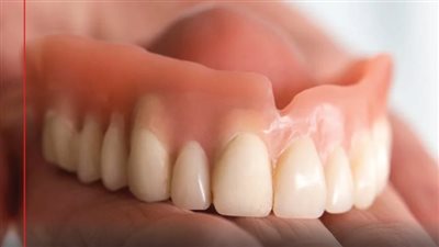 إخراج طقم أسنان اصطناعية من معدة مريض بعد 6 سنوات من ابتلاعه