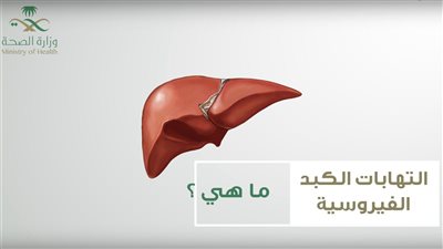 ما هي أعراض الكبد الوبا-ئي أ ؟