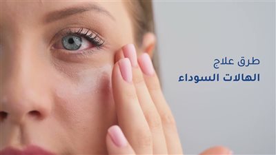طرق علاج الهالات السوداء