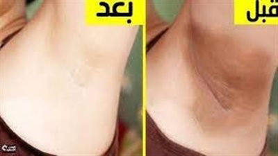 التخلص من اسمرار المناطق الحساسة: طرق طبيعية وطبية