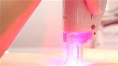 طريقة إزالة الشعر الصغير بالحلاوة: خطوات سهلة وفعالة