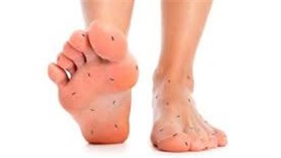 أسباب تنميل الرجلين