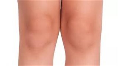 تخلص من سواد الركب في خطوات بسيطة
