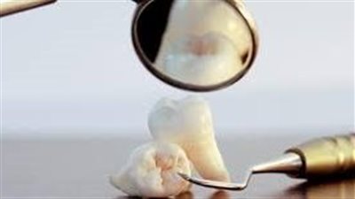 كم عدد ضروس العقل؟