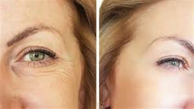 5 تقنيات لمنع ظهور تجاعيد الوجه