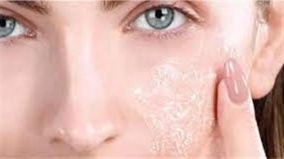 أسباب ظهور قشور في الوجه: 5 أسباب شائعة