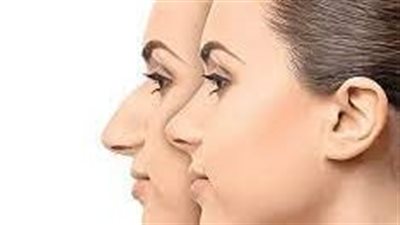 أسرار النتائج المثالية بعد تجميل الأنف: دليلك للعناية والراحة