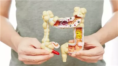 علاج الإمساك بأساليب طبيعية في المنزل