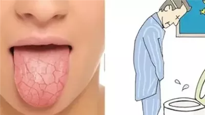 أعراض تحذيرية تدل على الإصابة بمرض السكري