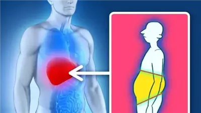 أسباب داخلية تؤدي إلى زيادة الوزن