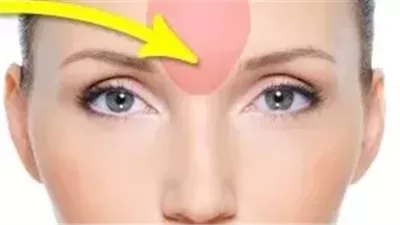 دلالة ظهور بثور في أماكن معيّنة في الوجه