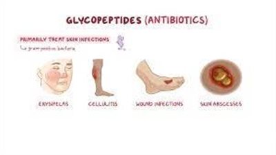 كل ما تريد معرفته عن استخدام Glycopeptides