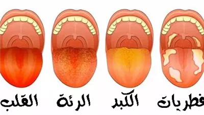 ما هي دلالة تغيير في لون اللسان أو لون اللعاب ؟