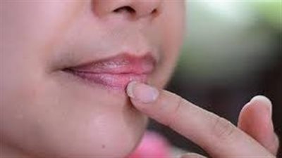 علاج تصبغات الشفاه: رحلةٌ نحو شفاهٍ ورديةٍ وصحيةٍ