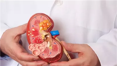 ما هي الحالات التي تتطلب استئصال جزء من الكلى ؟