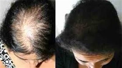 وداعاً للشعرِ الخفيفِ: رحلةٌ نحو شعرٍ كثيفٍ وجميلٍ