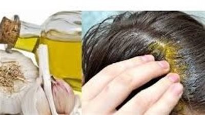 كيف تُصبح ذا شعر كثيف وجميل باستخدام الثوم؟