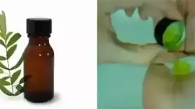 أساليب للحصول على فروة رأس صحيّة