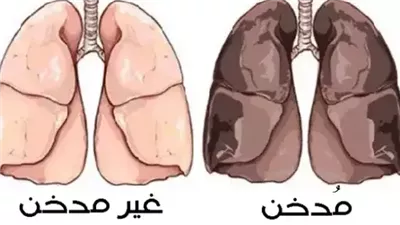 وصفة لتنظيف رئتيك من آثار الټدخين