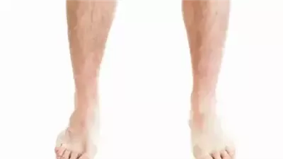 أعراض إذا ظهرت على القدم فإنها قد تكون دليلاً على وجود أمراض
