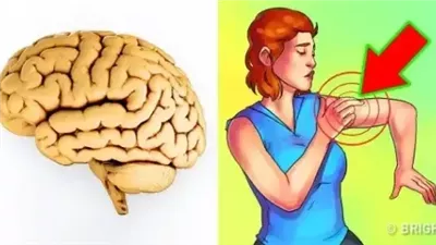 أعراض شائعة تدل على الإصابة بالسكتة الدماغية