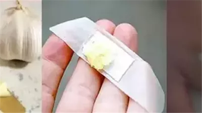 مكونات طبيعية للتخلص من الشامات