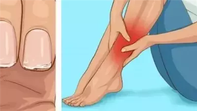 أعراض الأستمرار على المشروبات الغازية