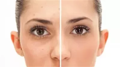 علاجات طبيعية لمشاكل رئيسية تخص مسام بشرتك