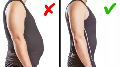 أساليب طبيعية للتغلُّب على مشكلة تحدب أسفل الرقبة
