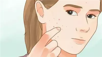 أعراض تظهر على الجلد بسبب التعرض للتوتر