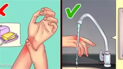 علاجات منزلية يجب الحذر من استخدامها