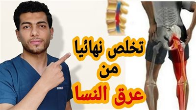 تمارين بسيطة لتخفيف حدة عرق النسا