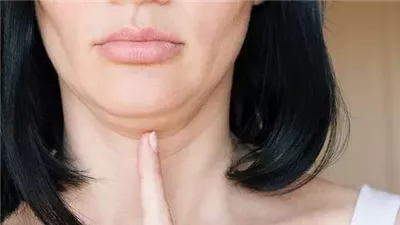 أساليب للتخلص من ترهلات الوجه والرقبة