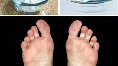 طُرُق سريعة للتخلص من تشقق الكعبين
