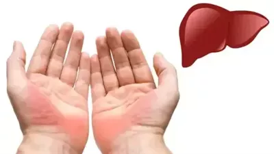  أعراض تظهر على اليدين والتي تكون بمثابة إنذار بوجود خلل في صحتك