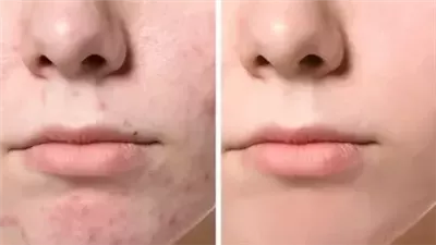 فوائد مذهلة لزيت الخروع للشعر والبشرة 
