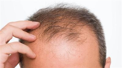 أنواع زيوت لمشاكل تساقط الشعر للرجال