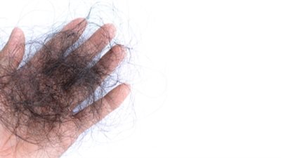 ما هي اسباب تساقط الشعر ؟ وما هو علاجة ؟