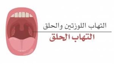 كيف نعالج التهاب الحلق منزلياً