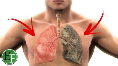 أطعمة تخلص الآنسان من آثار الټدخيڼ