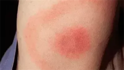 حالات مرضيّة تتشابه أعراضها وتتسبب في إعطاء تشخيص طبي خاطئ