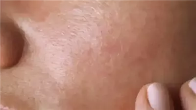 خرافات شائعة نتبعها عن التعامل مع بشرتنا