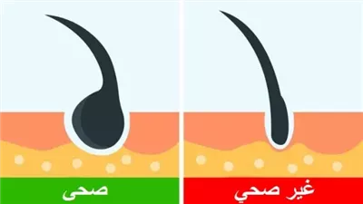 اختبارات يمكنك تجربتها بنفسك للتأكد من امتلاكك لشعر صحيّ