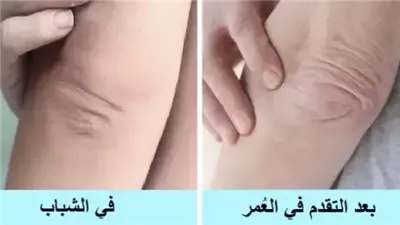 أماكن في الجسم بخلاف الوجه تظهر عليها أعراض الشيخوخة وتفصح عن عمرنا الحقيقي