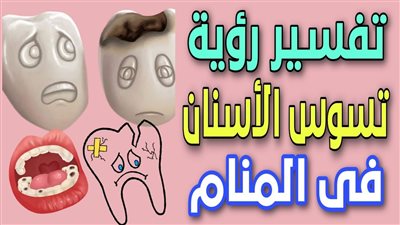 ما هو تفسير حلم تسوس الأسنان ؟