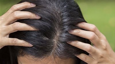 طرق علاج الشعر الأبيض المبكر